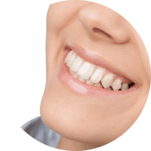 Dentista-En-Otay-Tijuana-Sonrisa-Blanca